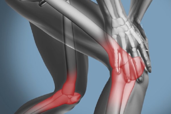 The Hidden Cause Behind Your Musculoskeletal Injuries