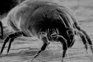 Home Alone with House Dust Mites