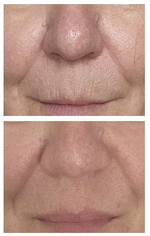 12 week comparison